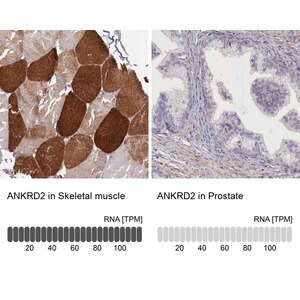Merck Anti-ANKRD2 antibody produced in rabbit
