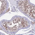 Merck Anti-AC004381.6 antibody produced in rabbit