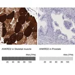 Merck Anti-ANKRD2 antibody produced in rabbit