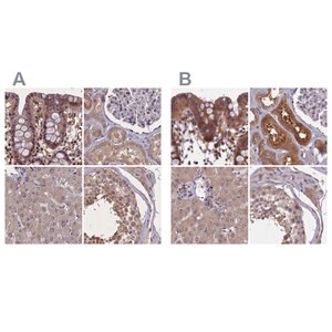 Merck Anti-NUBP1 antibody produced in rabbit