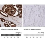 Merck Anti-SEMG2 antibody produced in rabbit