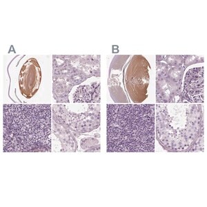 Merck Anti-BFSP1 antibody produced in rabbit