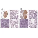 Merck Anti-BFSP1 antibody produced in rabbit