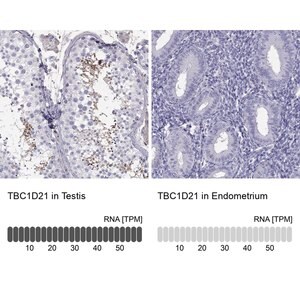 Merck Anti-TBC1D21 antibody produced in rabbit