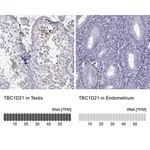 Merck Anti-TBC1D21 antibody produced in rabbit