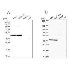 Merck Anti-CCDC94 antibody produced in rabbit