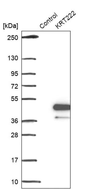 Merck Anti-KRT222 antibody produced in rabbit