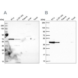 Merck Anti-GIPC1 antibody produced in rabbit