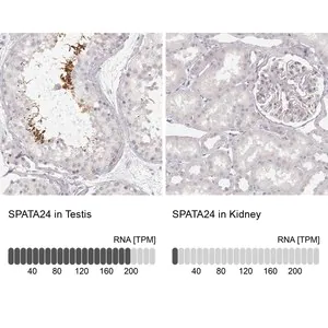 Merck Anti-SPATA24 antibody produced in rabbit