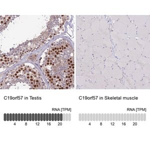 Merck Anti-C19orf57 antibody produced in rabbit