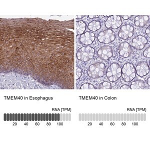Merck Anti-TMEM40 antibody produced in rabbit