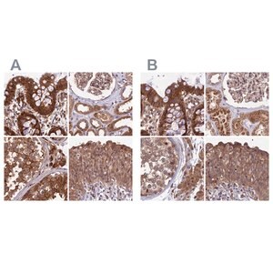 Merck Anti-MKKS antibody produced in rabbit