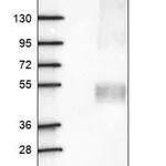 Merck Anti-TMEM104 antibody produced in rabbit