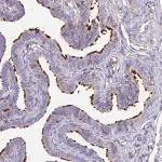 Merck Anti-NME5 antibody produced in rabbit