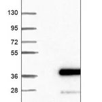 Merck Anti-SLC39A3 antibody produced in rabbit