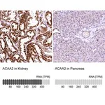 Merck Anti-ACAA2 antibody produced in rabbit