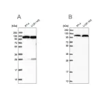 Merck Anti-AARS antibody produced in rabbit