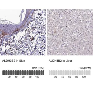 Merck Anti-ALDH3B2 antibody produced in rabbit