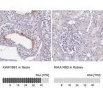 Merck Anti-KIAA1683 antibody produced in rabbit