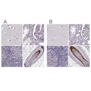 Merck Anti-TCHHL1 antibody produced in rabbit