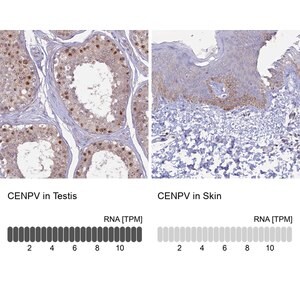 Merck Anti-CENPV antibody produced in rabbit