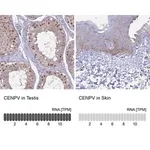 Merck Anti-CENPV antibody produced in rabbit
