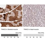 Merck Anti-TNNC2 antibody produced in rabbit