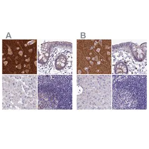 Merck Anti-SNAP91 antibody produced in rabbit