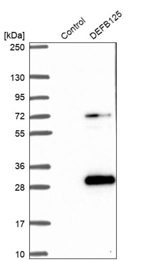 Merck Anti-DEFB125 antibody produced in rabbit