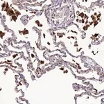 Merck Anti-IRAK3 antibody produced in rabbit