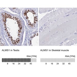 Merck Anti-ALMS1 antibody produced in rabbit