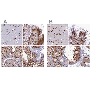 Merck Anti-DDX1 antibody produced in rabbit