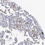 Merck Anti-RTKN2 antibody produced in rabbit