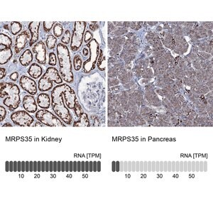Merck Anti-MRPS35 antibody produced in rabbit