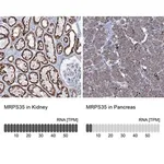 Merck Anti-MRPS35 antibody produced in rabbit