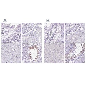 Merck Anti-SPERT antibody produced in rabbit