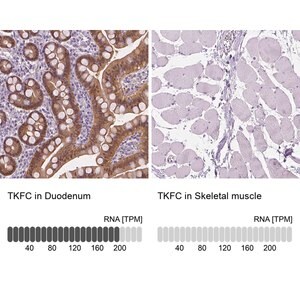 Merck Anti-TKFC antibody produced in rabbit
