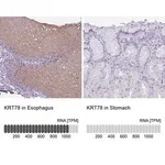 Merck Anti-KRT78 antibody produced in rabbit
