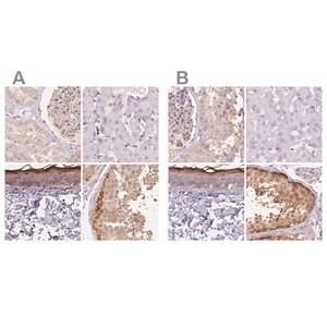 Merck Anti-BLMH antibody produced in rabbit
