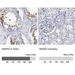 Merck Anti-AKAP3 antibody produced in rabbit