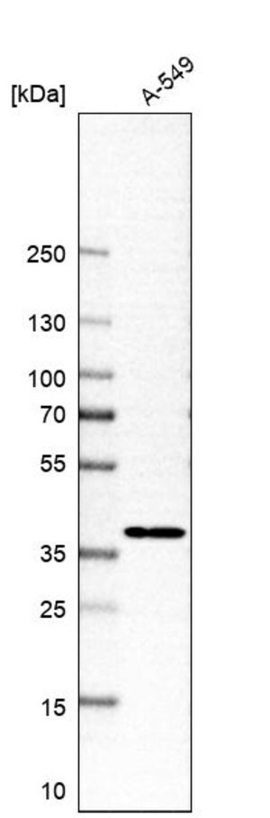 Merck Anti-MFSD5 antibody produced in rabbit