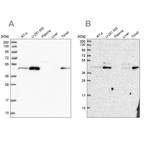 Merck Anti-ZDHHC16 antibody produced in rabbit