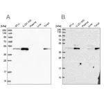 Merck Anti-ZDHHC16 antibody produced in rabbit