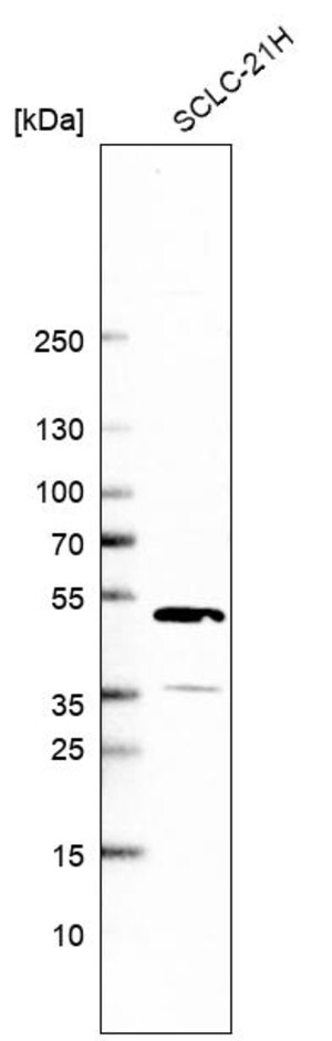 Merck Anti-CLYBL antibody produced in rabbit