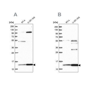 Merck Anti-TRMT112 antibody produced in rabbit