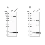 Merck Anti-TRMT112 antibody produced in rabbit