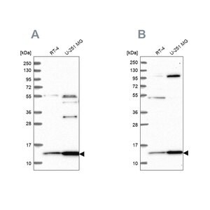 Merck Anti-TRMT112 antibody produced in rabbit