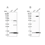 Merck Anti-TRMT112 antibody produced in rabbit
