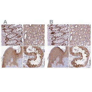 Merck Anti-WDR61 antibody produced in rabbit