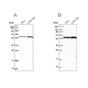 Merck Anti-INTS14 antibody produced in rabbit